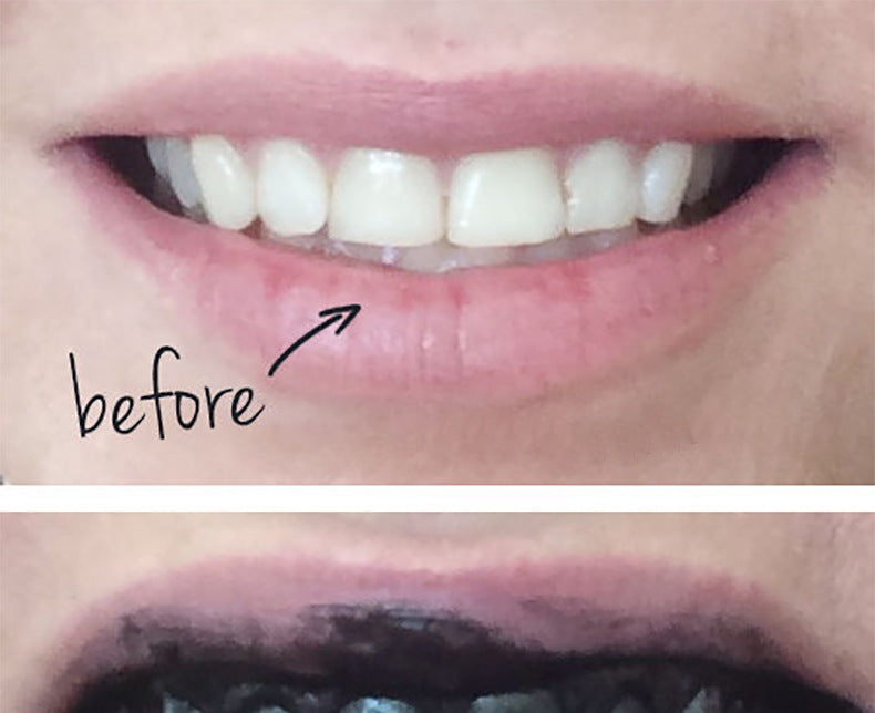 New Charcoal Teeth Whitning and Gum Detoxifying System