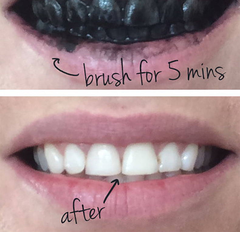 New Charcoal Teeth Whitning and Gum Detoxifying System