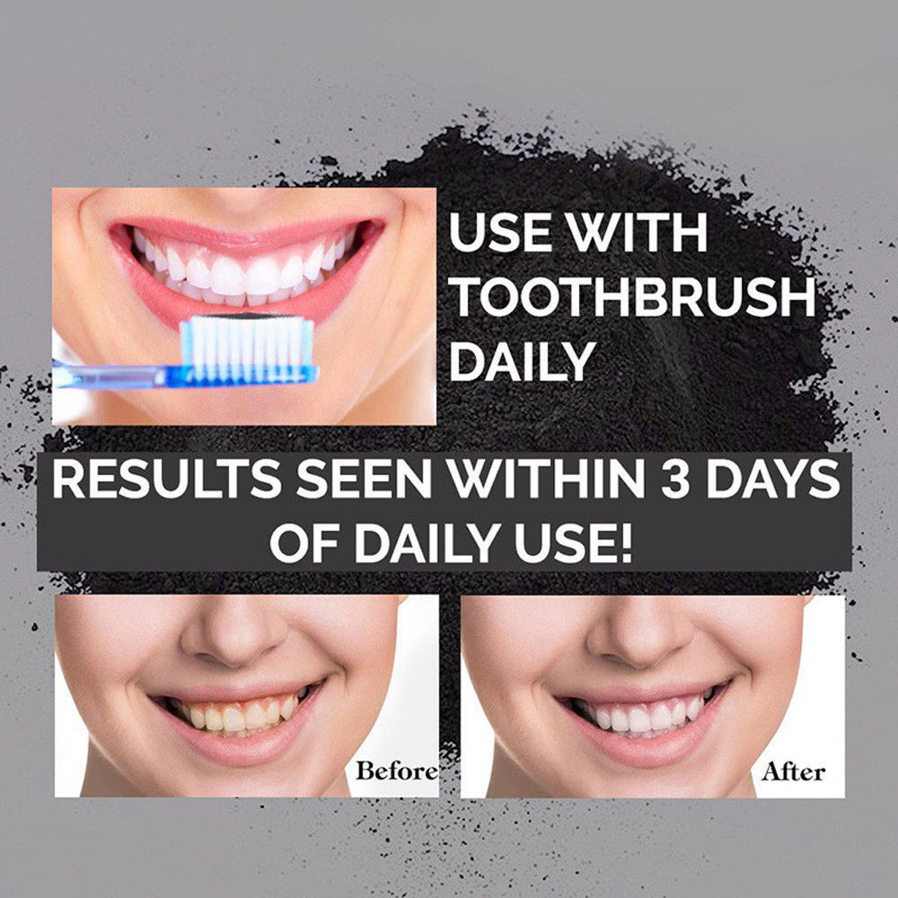New Charcoal Teeth Whitning and Gum Detoxifying System