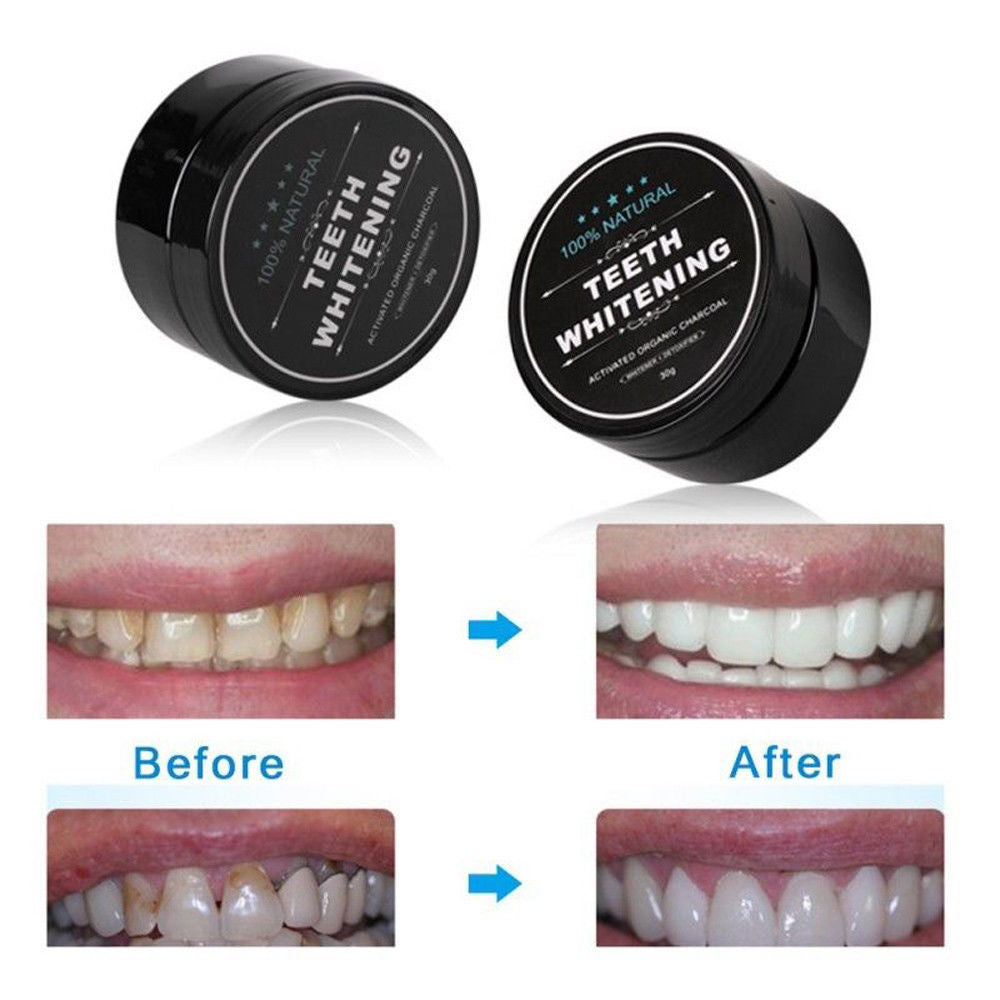 New Charcoal Teeth Whitning and Gum Detoxifying System